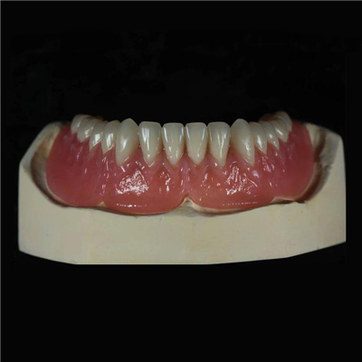 Removable Acrylic Full Denture